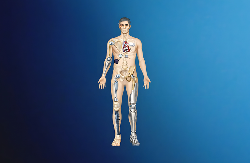 Industries Served by Aries Alloys